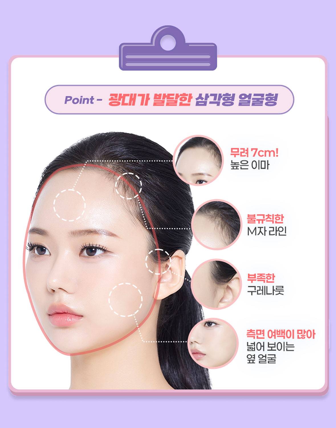 진단 포인트