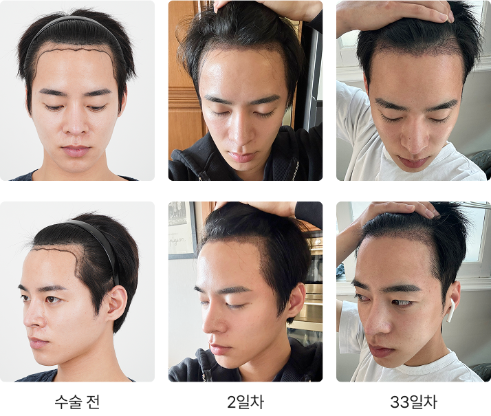 Transformation Process 1
