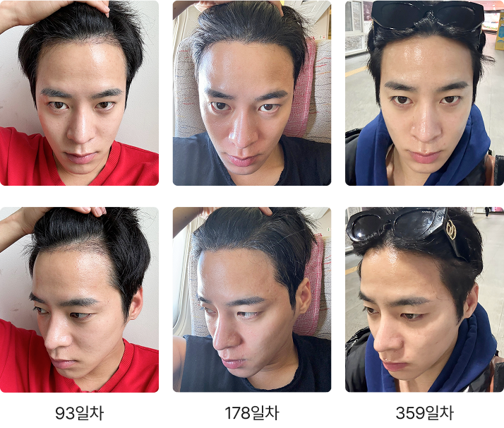 Transformation Process 2