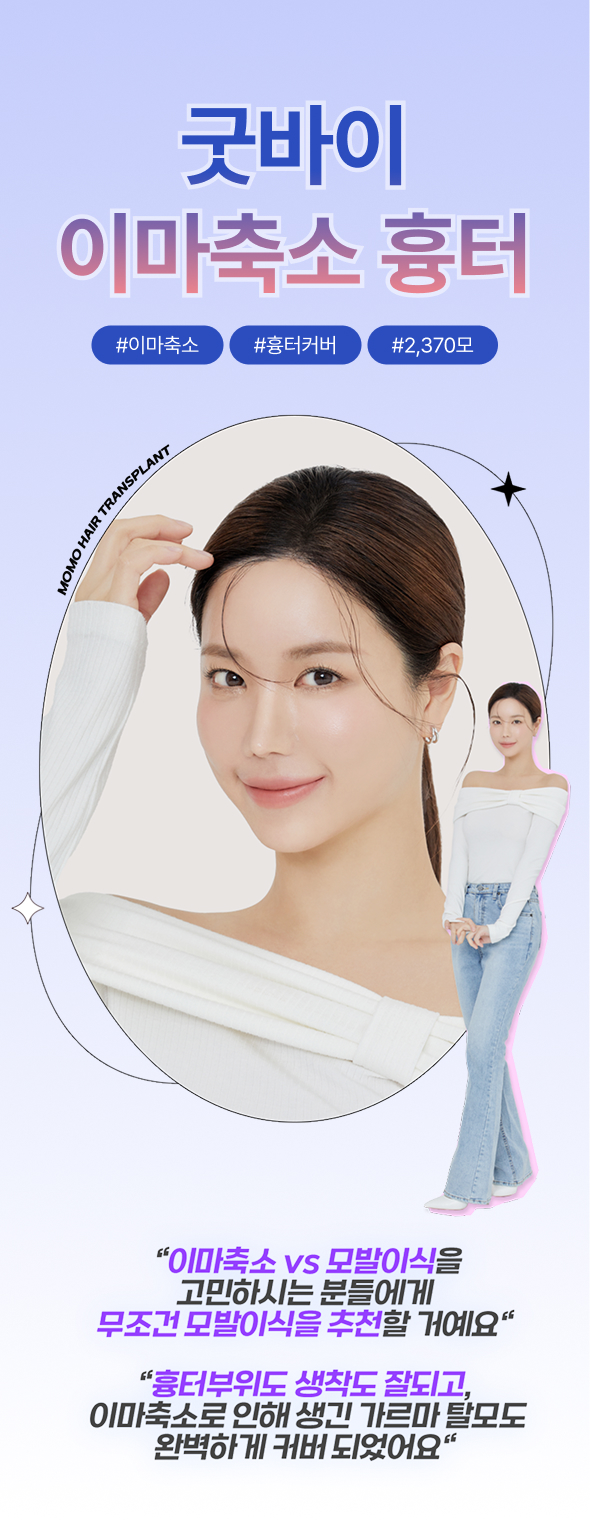 모델 배너