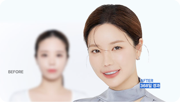 頭頂部の薄毛に10年悩み、ついに解決！