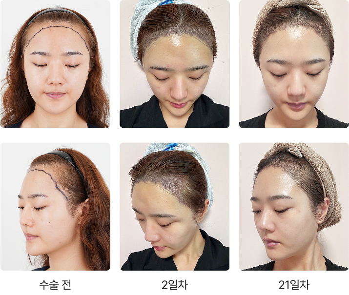 Transformation Process 1