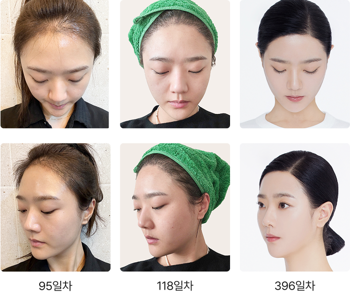 Transformation Process 2