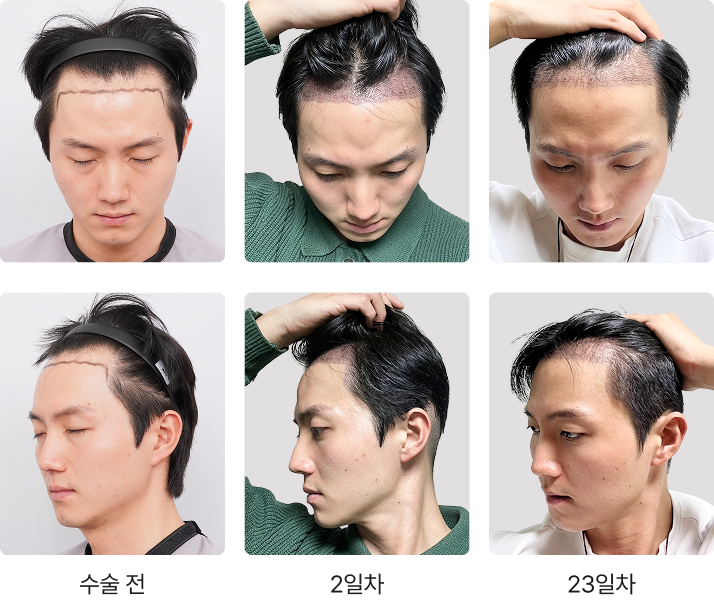 Transformation Process 1