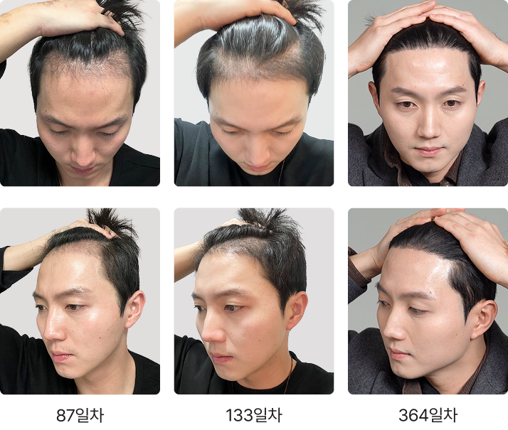 Transformation Process 2