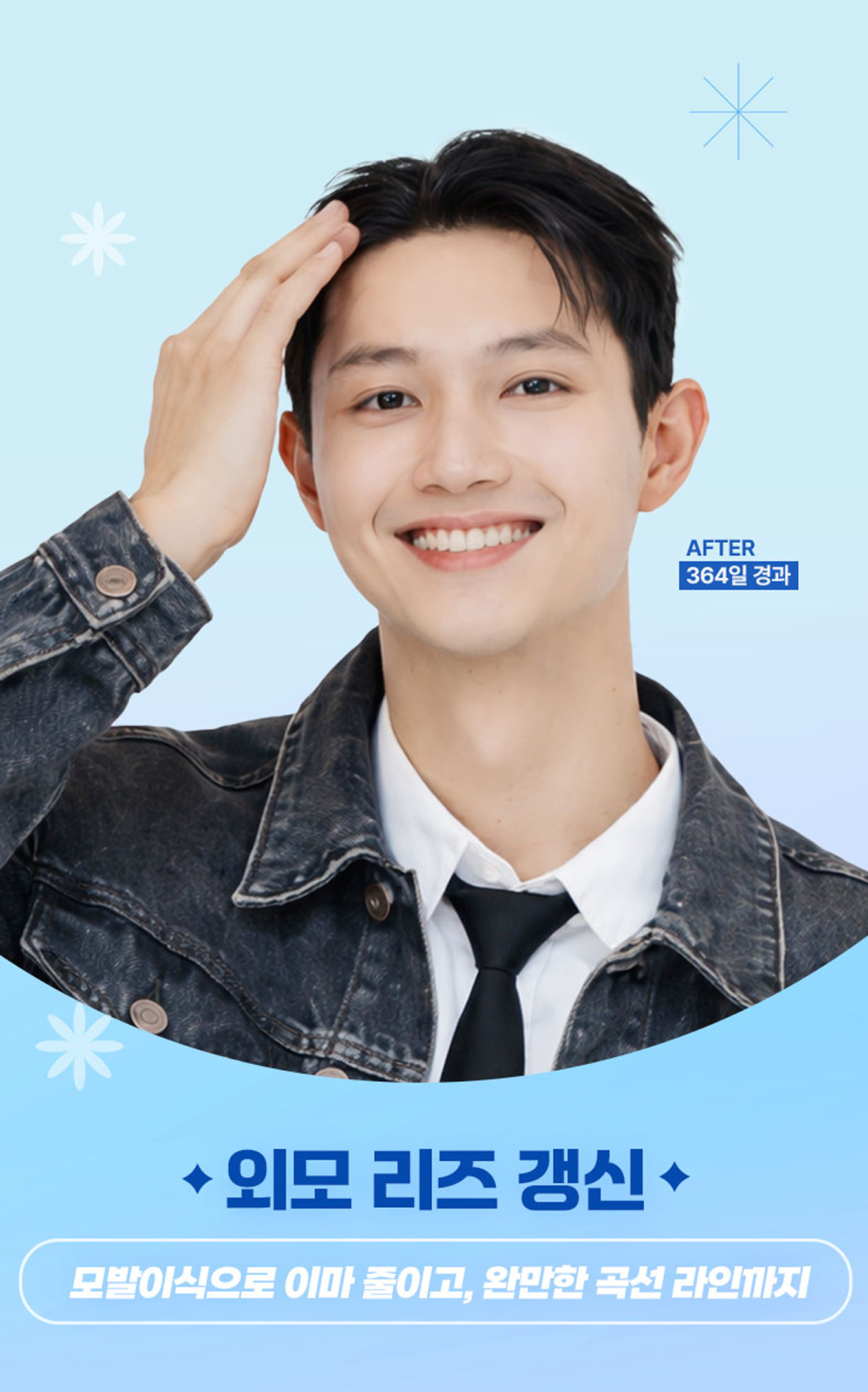 이마 줄이고, 외모 리즈 갱신