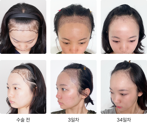 Transformation Process 1