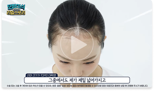 상담 영상 1