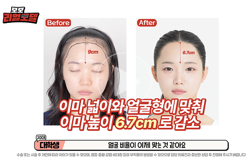 MOMO Real Model Video 1