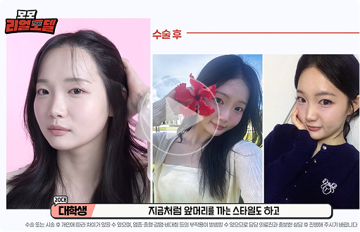 MOMO Real Model Video 2