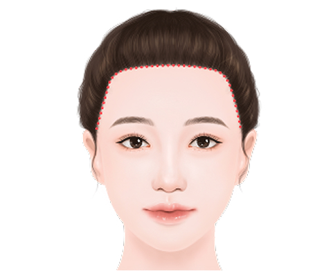方形额头
