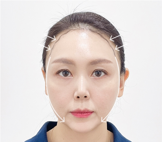 圆脸型