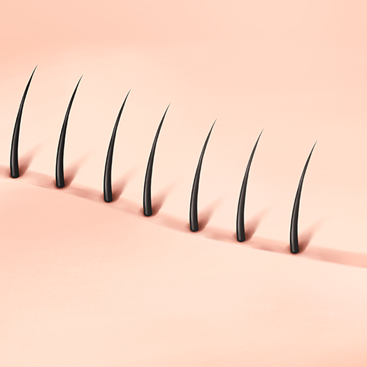 Scar cover hair transplant surgery process 01